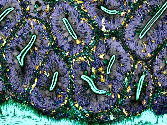 18. A network of white blood cells in a zebrafish intestine.