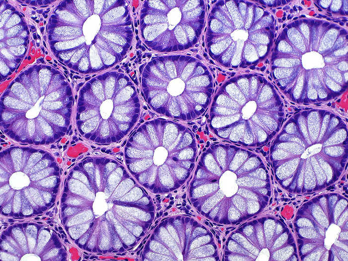 15. Cross sections of cells from the lining of a human colon, which look like a sea of flowers.