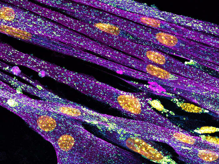 14. Mouse myoblasts — precursors of the cells that build muscle tissue — with their nuclei in yellow, lysosomes in cyan or green, and filaments in magenta.