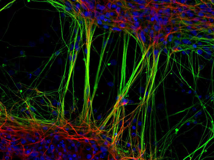 7. Neurons from human neural stem cells.