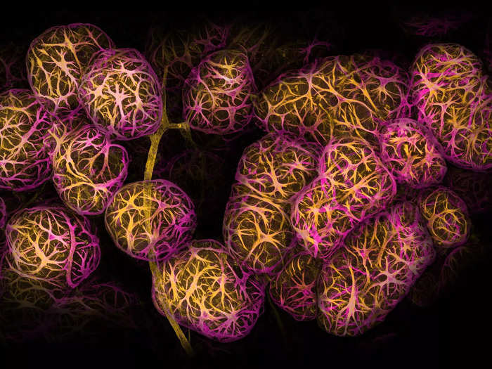 Second place went to this close-up photo of breast tissue, showing cells wrapped around the alveoli that produce milk.