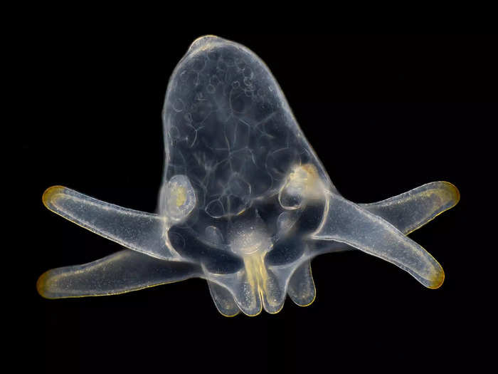 Scientists, artists, and enthusiasts from all over the world submit their painstakingly crafted photos of cells, nerves, micro crystals, mold, and tiny creatures like this anemone larva.