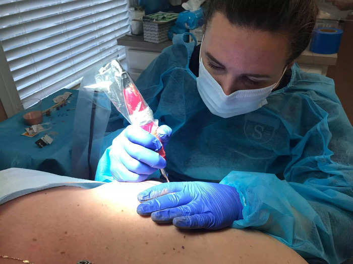 LaCorte left her career as a classical artist to become a medical tattooist.