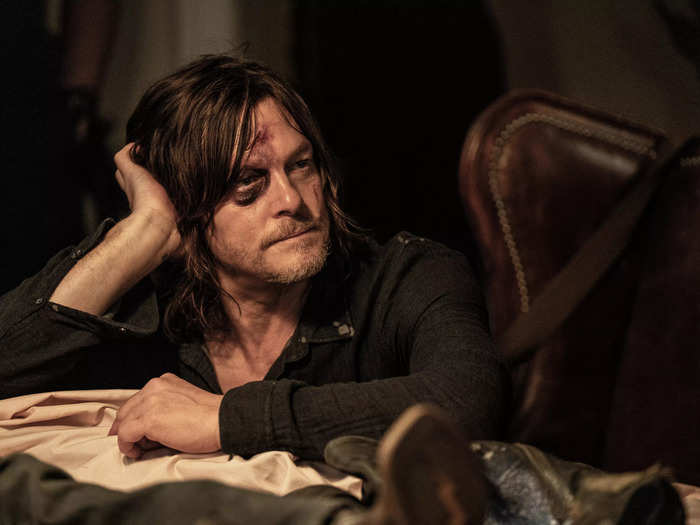 Daryl received his black eye off-screen when he was hit by a Commonwealth soldier.