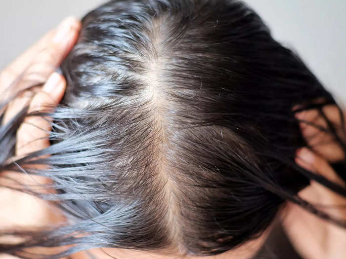 This year, we also got the first ever comprehensive study of supplements for hair loss