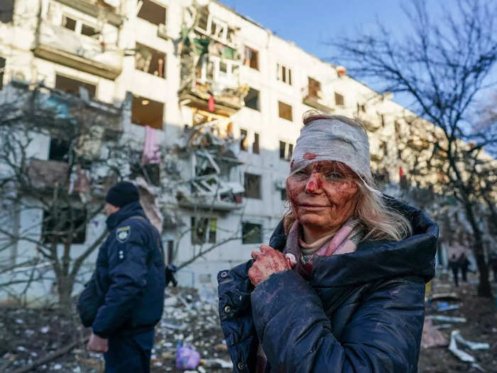 Thw wounded Ukrainian teacher Olena Kurilo made international headlines with this picture of her standing outside her destroyed home.