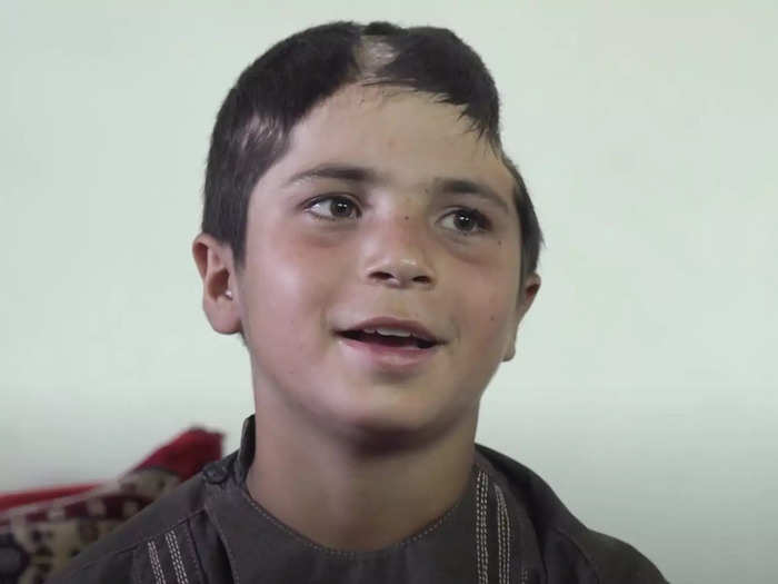 Salahuddin Mohammadi was just seven years old when he was injured by an explosive.