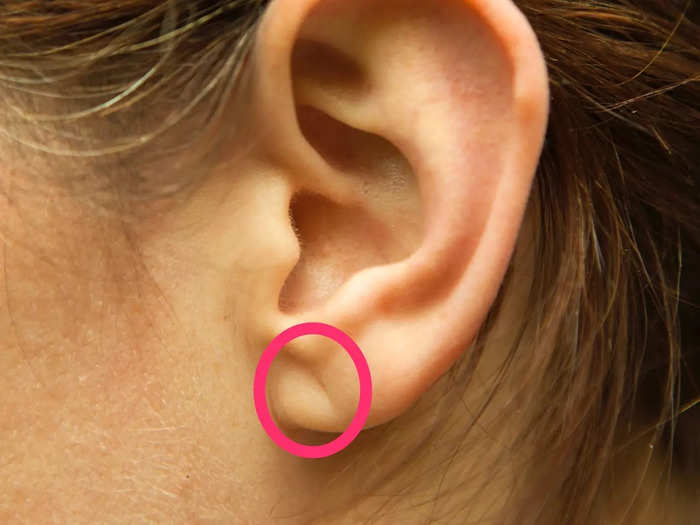 If your earlobe is "creased," or bent at a 45 degree angle, you might be at a greater risk for heart problems.