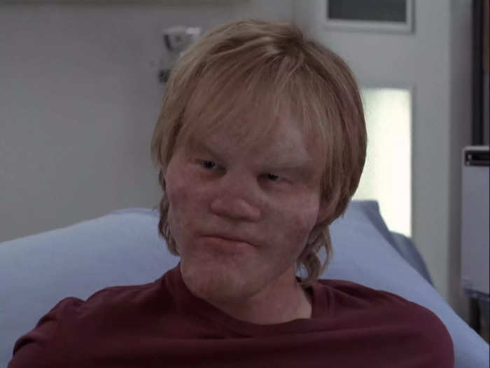 Jesse Plemons played a patient who died quickly.