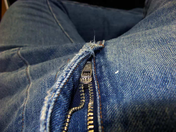 Men have reported genital trauma after accidentally getting their penises stuck in their pant zippers.