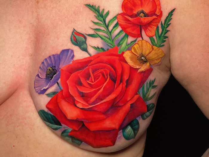 A floral tattoo conceals a breast cancer mastectomy scar